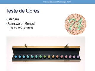 Teste de Cores
• Ishihara
• Farnsworth-Munsell
• 15 ou 100 (88) tons
XI Curso Básico de Oftalmologia HCPA
 
