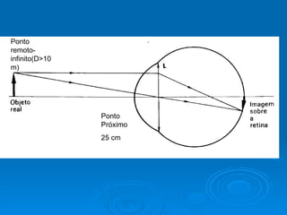 Ponto Próximo 25 cm Ponto remoto-infinito(D >10m) 