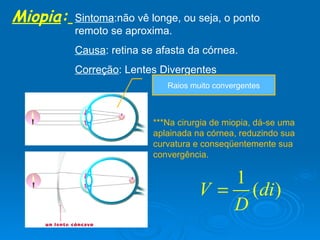 Miopia :   Sintoma :não vê longe, ou seja, o ponto remoto se aproxima. Causa : retina se afasta da córnea. Correção : Lentes Divergentes ***Na cirurgia de miopia, dá-se uma aplainada na córnea, reduzindo sua  curvatura e conseqüentemente sua convergência. Raios muito convergentes 