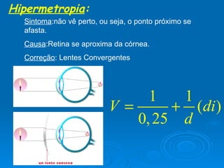 Hipermetropia : Sintoma :não vê perto, ou seja, o ponto próximo se afasta. Causa :Retina se aproxima da córnea. Correção : Lentes Convergentes 