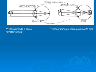 ***Olho mirando o ponto remoto(“infinito”) ***Olho mirando o ponto próximo(25 cm) 
