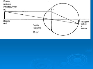 Ponto Próximo 25 cm Ponto remoto-infinito(D >10m) 