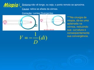 Miopia :   Sintoma :não vê longe, ou seja, o ponto remoto se aproxima. Causa : retina se afasta da córnea. Correção : Lentes Divergentes ***Na cirurgia de miopia, dá-se uma aplainada na córnea, reduzindo sua  curvatura e conseqüentemente sua convergência. 