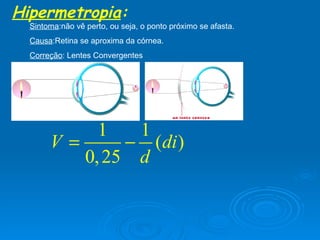 Hipermetropia : Sintoma :não vê perto, ou seja, o ponto próximo se afasta. Causa :Retina se aproxima da córnea. Correção : Lentes Convergentes 