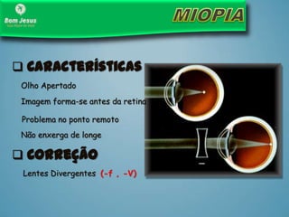 Olho Apertado
Imagem forma-se antes da retina
Problema no ponto remoto
 Características
 Correção
Lentes Divergentes (-f , -V)
Não enxerga de longe
 