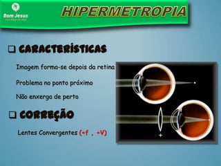 Imagem forma-se depois da retina
Problema no ponto próximo
 Características
 Correção
Lentes Convergentes (+f , +V)
Não enxerga de perto
 