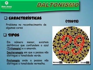 Problema no reconhecimento de
algumas cores
 Características
 Tipos
Deuteranopia em que a pessoa não
distingue a tonalidade verde.
Protanopia onde a pessoa não
distingue a tonalidade vermelha.
Em número menor, existem
daltônicos que confundem o azul
(Tritanopia) e o amarelo.
(TESTE)
 