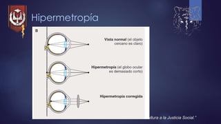 Hipermetropía
“Por la Cultura a la Justicia Social.”
 