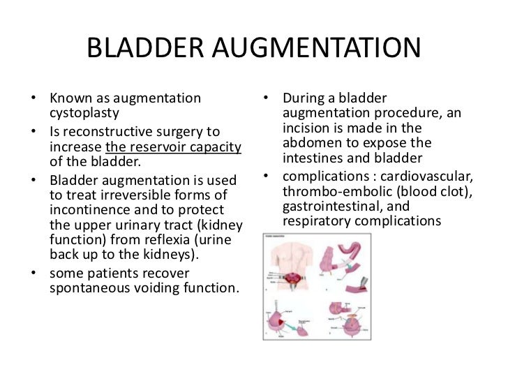 Pt in urosurgery