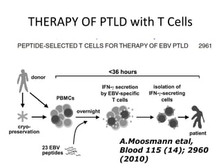 THERAPY OF PTLD with T Cells
A.Moosmann etal,
Blood 115 (14); 2960
(2010)
 