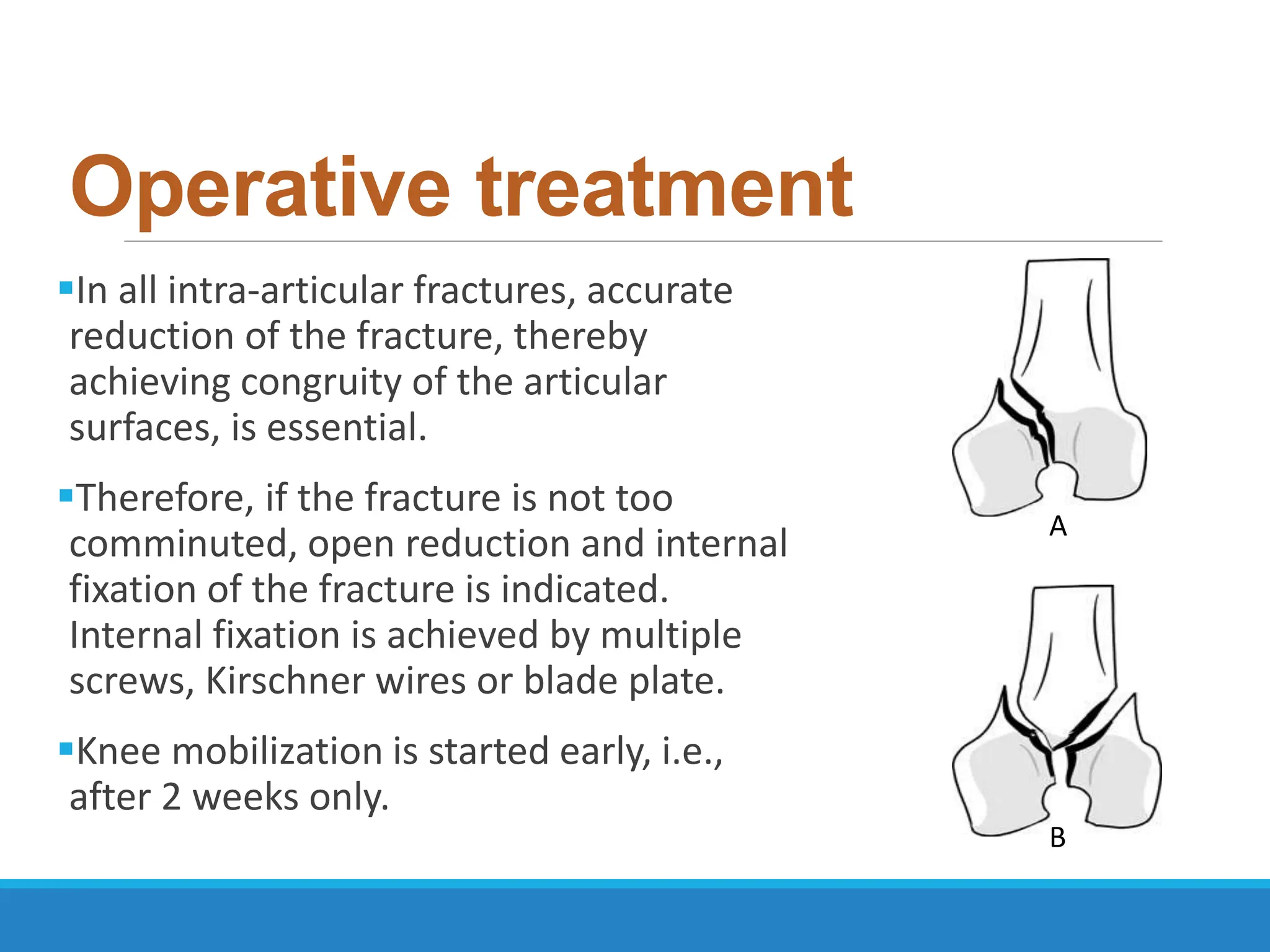 PT Management of Fractures of Condyles of Femur | PPTX