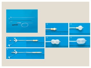 Ptmc Ed Percutaneous transmitral commisurotomy PTMC-New Final latest.pptx