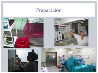 Preparación
 