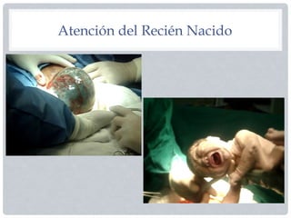 Atención del Recién Nacido
 