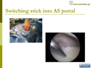 Switching stick into AS portal
www.shoulder.gr
 