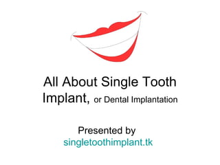 All About Single Tooth
Implant, or Dental Implantation

       Presented by
    singletoothimplant.tk
 