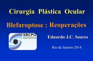 Cirurgia Plástica Ocular
Reoperações
Eduardo J.C. Soares
Blefaroptose :
Rio de Janeiro 2014
 