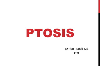 PTOSIS
SATISH REDDY A.N
4127

 