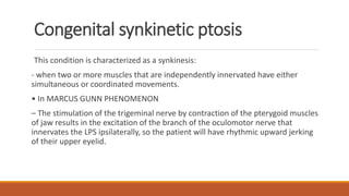 Congenital synkinetic ptosis
This condition is characterized as a synkinesis:
- when two or more muscles that are independently innervated have either
simultaneous or coordinated movements.
• In MARCUS GUNN PHENOMENON
– The stimulation of the trigeminal nerve by contraction of the pterygoid muscles
of jaw results in the excitation of the branch of the oculomotor nerve that
innervates the LPS ipsilaterally, so the patient will have rhythmic upward jerking
of their upper eyelid.
 