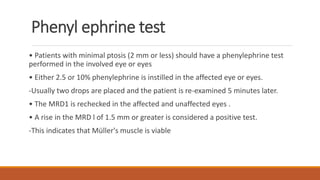 Phenyl ephrine test
• Patients with minimal ptosis (2 mm or less) should have a phenylephrine test
performed in the involved eye or eyes
• Either 2.5 or 10% phenylephrine is instilled in the affected eye or eyes.
-Usually two drops are placed and the patient is re-examined 5 minutes later.
• The MRD1 is rechecked in the affected and unaffected eyes .
• A rise in the MRD l of 1.5 mm or greater is considered a positive test.
-This indicates that Müller's muscle is viable
 