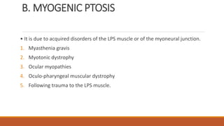 B. MYOGENIC PTOSIS
• It is due to acquired disorders of the LPS muscle or of the myoneural junction.
1. Myasthenia gravis
2. Myotonic dystrophy
3. Ocular myopathies
4. Oculo-pharyngeal muscular dystrophy
5. Following trauma to the LPS muscle.
 