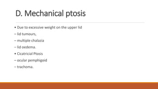 D. Mechanical ptosis
• Due to excessive weight on the upper lid
– lid tumours,
– multiple chalazia
– lid oedema.
• Cicatricial Ptosis
– ocular pemphigoid
– trachoma.
 
