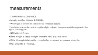 measurements
1. MARGIN REFLEX DISTANCE
• Margin-to-reflex distance 1 (MRD1) :
– When light is thrown on the cornea a reflection occurs .
-The distance from the central pupillary light reflex to the upper eyelid margin with the
eye in primary gaze.
• NORMAL : 4 - 5 mm.
• If the margin is above the light reflex the MRD 1 is a +ve value.
• If the lid margin is below the corneal reflex in cases of very severe ptosis the
MRD1 would be a –ve value.
 