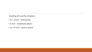 Grading of severity of ptosis
< or = 2mm : mild ptosis
= 3 mm : moderate ptosis
= or > 4 mm : severe ptosis
 