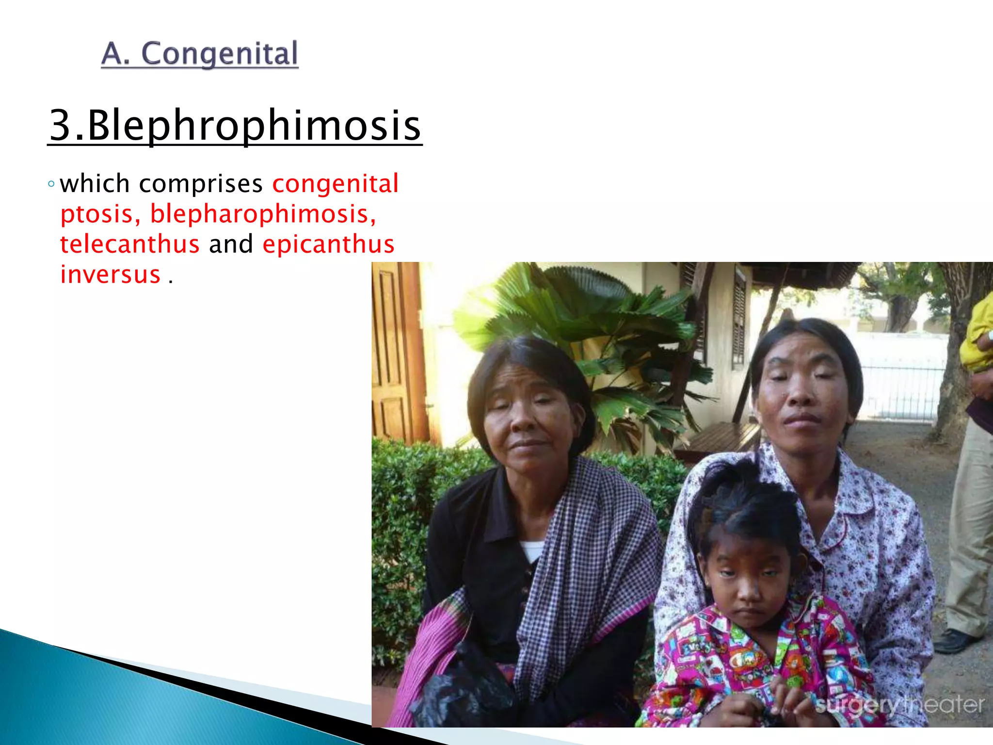 Ptosis | PPTX