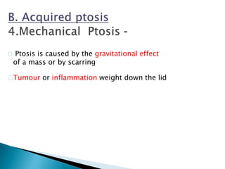 Ptosis is caused by the gravitational effect
of a mass or by scarring
Tumour or inflammation weight down the lid
 