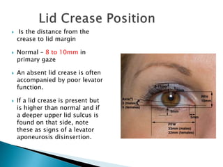  Is the distance from the
crease to lid margin
 Normal – 8 to 10mm in
primary gaze
 An absent lid crease is often
accompanied by poor levator
function.
 If a lid crease is present but
is higher than normal and if
a deeper upper lid sulcus is
found on that side, note
these as signs of a levator
aponeurosis disinsertion.
 