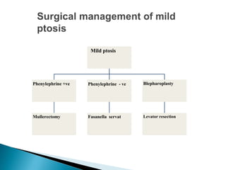 Mild ptosis
Phenylephrine +ve
Mullerectomy
Phenylephrine - ve
Fasanella servat
Blepharoplasty
Levator resection
 