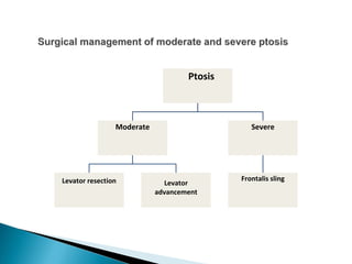 Ptosis
Moderate
Levator resection Levator
advancement
Severe
Frontalis sling
 