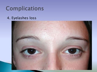 4. Eyelashes loss
 