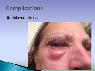 6. Unfavorable scar
 