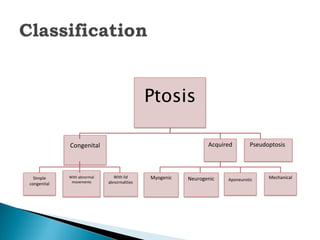 Ptosis
Congenital
Simple
congenital
With abnormal
movements
With lid
abnormalities
Acquired
Myogenic Neurogenic Aponeurotic Mechanical
Pseudoptosis
 