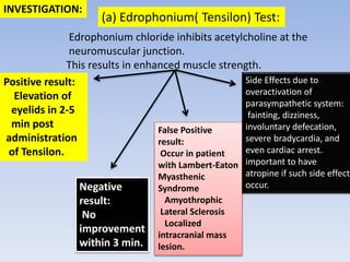 Edrophonium chloride inhibits acetylcholine at the
neuromuscular junction.
This results in enhanced muscle strength.
Positive result:
Elevation of
eyelids in 2-5
min post
administration
of Tensilon.
Negative
result:
No
improvement
within 3 min.
False Positive
result:
Occur in patient
with Lambert-Eaton
Myasthenic
Syndrome
Amyothrophic
Lateral Sclerosis
Localized
intracranial mass
lesion.
Side Effects due to
overactivation of
parasympathetic system:
fainting, dizziness,
involuntary defecation,
severe bradycardia, and
even cardiac arrest.
important to have
atropine if such side effect
occur.
INVESTIGATION:
(a) Edrophonium( Tensilon) Test:
 
