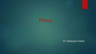 Ptosis
-Dr. Deepayan Sarkar
 