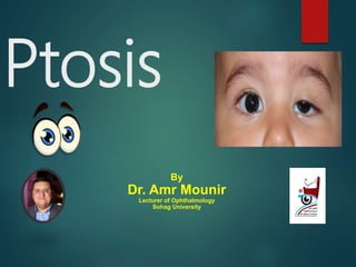 Ptosis
By
Dr. Amr Mounir
Lecturer of Ophthalmology
Sohag University
 