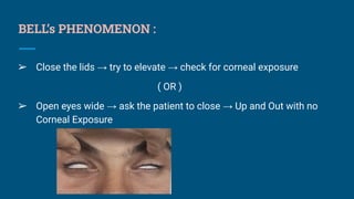 Bell's Reflex PTOSIS OF UPPER LID AND MANAGEMENT OF PTOSIS | PDF