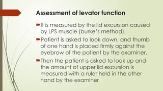 PTOSIS (BLEPHAROPTOSIS) Upper lof Disease.pptx