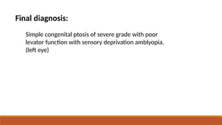 ptosis case ArG.pptxdududjendjddisossie8ehe | PPTX