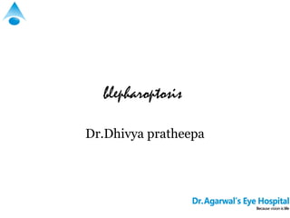 blepharoptosis

Dr.Dhivya pratheepa
 
