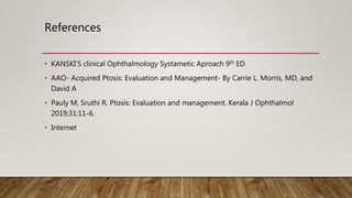 References
• KANSKI’S clinical Ophthalmology Systametic Aproach 9th ED
• AAO- Acquired Ptosis: Evaluation and Management- By Carrie L. Morris, MD, and
David A
• Pauly M, Sruthi R. Ptosis: Evaluation and management. Kerala J Ophthalmol
2019;31:11-6.
• Internet
 