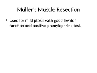 Levator Function Testing Ptosis_MS_Ophthalmology_Presentation 6.pptx