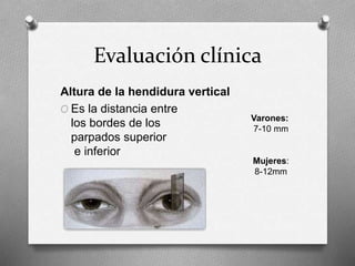 Evaluación clínica
Altura de la hendidura vertical
O Es la distancia entre
los bordes de los
parpados superior
e inferior
Varones:
7-10 mm
Mujeres:
8-12mm
 