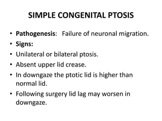 Ptosis | PPTX