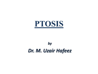 PTOSIS 
by 
Dr. M. Uzair Hafeez 
 