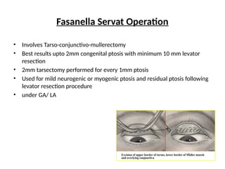 Parsectomy Case of ptosis and it’s diagnosis and management | PPTX
