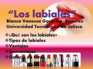 Blanca Vanessa González Ramírez
Universidad Tecnológica de Jalisco
¿Qué son los labiales?
Tipos de labiales
Ventajas
Desventajas
Galería de fotos
 